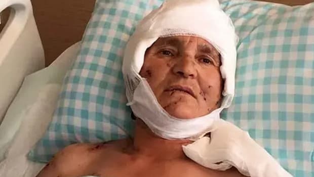 Yargıtay'dan köpek saldırısı kararı: Malul kalan kadına 637 bin lira tazminat