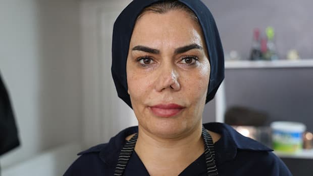Kırılan burnunu düzeltmek istedi, hayatı kabusa döndü: Doktoruna dava açtı